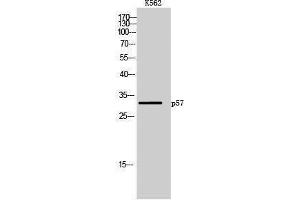 Western Blotting (WB) image for anti-P57 (Ser238) antibody (ABIN6282566) (P57 (Ser238) 抗体)