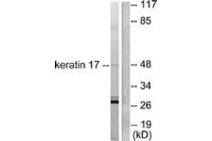 Western blot analysis of extracts from HuvEc cells, using Keratin 17 Antibody. (KRT17 抗体  (AA 381-430))