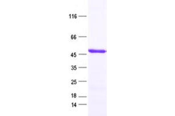 RBMY1A1 Protein (His tag)