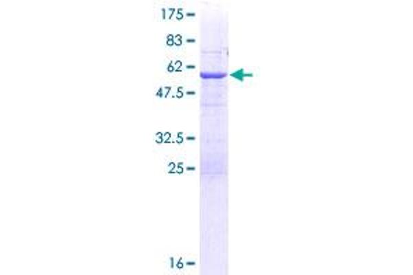 ABCC10 Protein (AA 1-282) (GST tag)