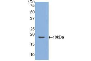 Western blot analysis of recombinant Mouse TM. (Thrombomodulin 抗体  (AA 31-167))