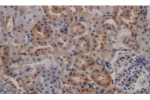 Immunohistochemistry of paraffin-embedded Rat kidney using PDGFRB Polyclonal Antibody at dilution of 1:50 (PDGFRB 抗体)