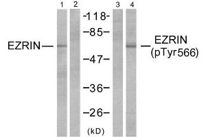 Western blot analysis of extracts from A431 cells, untreated or EGF-treated (200ng/ml, 30min) using Ezrin (Ab-566) antibody (E021200, Lane 1 and 2) and Ezrin (phospho-Thr566) antibody (E011202, Lane 3 and 4). (Ezrin 抗体)