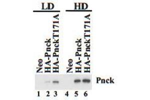 Neo, HA-Pnck and HA-Pnck T171A HEK-293 cells were plated at low (LD) and high (HD) cell density and lysates prepared after 48 hours. (PNCK 抗体  (C-Term))