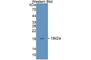 Detection of Recombinant SNAPAP, Human using Polyclonal Antibody to SNAP Associated Protein (SNAPAP) (SNAPIN 抗体  (AA 2-136))