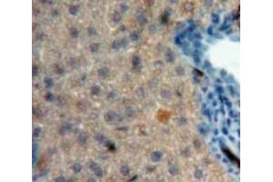 Used in DAB staining on fromalin fixed paraffin-embedded Liver tissue (CRH 抗体  (AA 40-195))