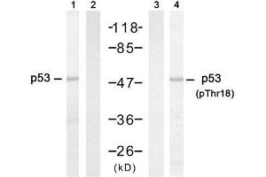 Western blot analysis of extracts from HT-29 cells untreated or treated with hydroxyurea, using p53 (Ab-18) antibody (E021086, Lane 1 and 2) and p53 (phospho-Thr18) antibody (E011095, Lane 3 and 4). (p53 抗体  (pThr18))