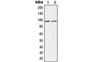 Western blot analysis of GIT1 expression in HuvEc (A), HeLa (B) whole cell lysates. (GIT1 抗体  (C-Term))