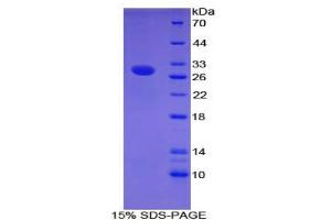 SDS-PAGE analysis of Mouse CNTNAP4 Protein. (CNTNAP4 蛋白)