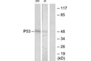 Western blot analysis of extracts from 293/Jurkat cells, treated with UV, using p53 (Ab-33) Antibody. (p53 抗体  (AA 16-65))