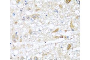 Immunohistochemistry of paraffin-embedded Rat brain using CBR4 Polyclonal Antibody at dilution of 1:100 (40x lens). (CBR4 抗体)