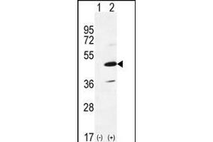 Western blot analysis of IRAK4 (arrow) using rabbit polyclonal IRAK4 Antibody (R20) (ABIN6243238 and ABIN6579012). (IRAK4 抗体  (N-Term))