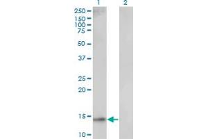 Western Blot analysis of UBE2D1 expression in transfected 293T cell line by UBE2D1 monoclonal antibody (M01), clone 2C6. (UBE2D1 抗体  (AA 1-94))