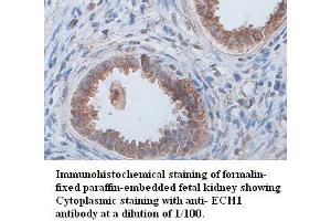 Image no. 1 for anti-Enoyl Coenzyme A Hydratase 1, Peroxisomal (ECH1) antibody (ABIN791173) (ECH1 抗体)