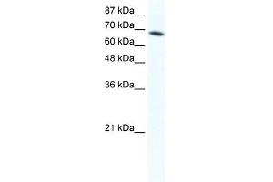 DDX1 antibody used at 1. (DDX1 抗体)