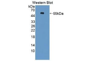 Detection of Recombinant Kim1, Human using Polyclonal Antibody to Kidney Injury Molecule 1 (Kim1) (HAVCR1 抗体  (AA 21-245))