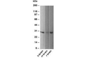 Western blot of human, mouse and rat brain lysate using PGP9. (UCHL1 抗体)