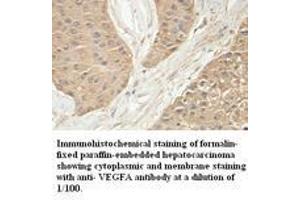 Image no. 1 for anti-Vascular Endothelial Growth Factor A (VEGFA) antibody (ABIN791193) (VEGFA 抗体)