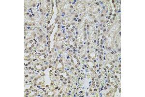 Immunohistochemistry of paraffin-embedded rat kidney using SMARCC2 antibody. (SMARCC2 抗体  (AA 150-250))