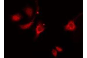 ABIN6276317 staining  HeLa cells by IF/ICC. (HSP27 抗体  (N-Term))