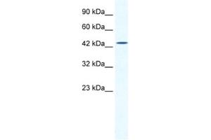 Western Blotting (WB) image for anti-DMRT-Like Family B with Proline-Rich C-terminal, 1 (DMRTB1) antibody (ABIN2461285) (DMRTB1 抗体)