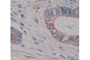 IHC-P analysis of Human Tissue, with DAB staining. (Oncostatin M Receptor 抗体  (AA 513-760))