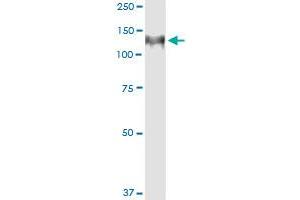 Western Blotting (WB) image for anti-Huntingtin Interacting Protein 1 (HIP1) (AA 928-1037) antibody (ABIN561263)