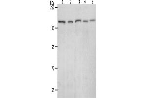 Western Blotting (WB) image for anti-RAD50 Homolog (S. Cerevisiae) (RAD50) antibody (ABIN2426375) (RAD50 抗体)