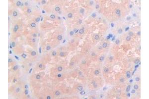 IHC-P analysis of Human Kidney Tissue, with DAB staining. (IL3RA 抗体  (AA 19-157))