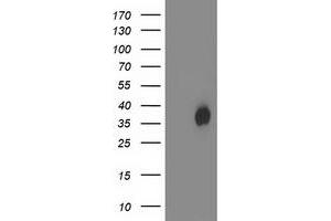 Western Blotting (WB) image for anti-Haloacid Dehalogenase-Like Hydrolase Domain Containing 2 (HDHD2) antibody (ABIN1498629) (HDHD2 抗体)