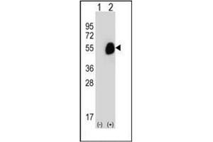 Western blot analysis of GCDH (arrow) using GCD / GCDH Antibody (C-term) Cat. (GCDH 抗体  (C-Term))