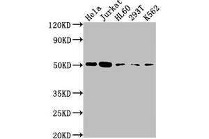 Western Blot Positive WB detected in: Hela whole cell lysate, Jurkat whole cell lysate, HL60 whole cell lysate, 293T whole cell lysate, K562 whole cell lysate All lanes: CASP2 antibody at 1:2000 Secondary Goat polyclonal to rabbit IgG at 1/50000 dilution Predicted band size: 51, 35, 11 kDa Observed band size: 51 kDa (Recombinant Caspase 2 抗体)