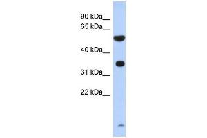 ESSPL antibody used at 1 ug/ml to detect target protein. (ESSPL 抗体  (N-Term))