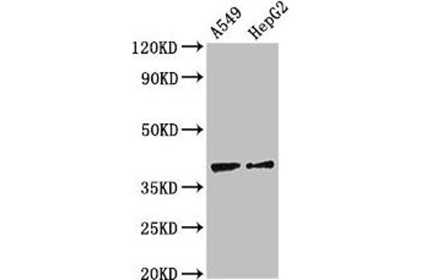 CCR1 抗体  (AA 314-362)