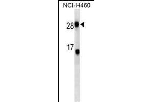 CRP Antibody (ABIN1539893 and ABIN2843851) western blot analysis in NCI- cell line lysates (35 μg/lane). (CRP 抗体  (AA 8-35))