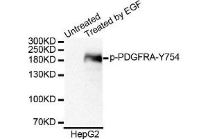 Western blot analysis of extracts of HepG2 cell line, using Phospho-PDGFRA-Y754 antibody. (PDGFRA 抗体  (pTyr754))