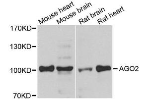 Western blot analysis of extracts of various cell lines, using AGO2 antibody (ABIN1877052) at 1:1000 dilution. (AGO2 抗体)