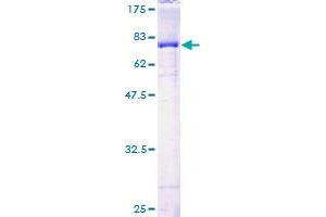 Image no. 1 for STAM Binding Protein (STAMBP) (AA 1-424) protein (GST tag) (ABIN1321555) (STAMBP Protein (AA 1-424) (GST tag))