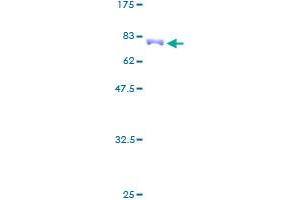 ENO3 Protein (AA 1-434) (GST tag)