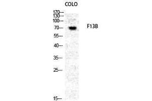 Western Blotting (WB) image for anti-Coagulation Factor 13, B Polypeptide (F13B) (N-Term) antibody (ABIN3175044) (F13B 抗体  (N-Term))