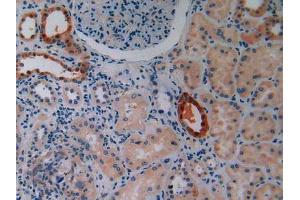 IHC-P analysis of Human Kidney Tissue, with DAB staining. (IGF2R 抗体  (AA 2167-2442))