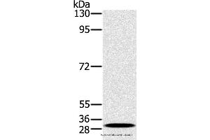 Western blot analysis of K562 cell, using RAB27A Polyclonal Antibody at dilution of 1:400 (RAB27A 抗体)