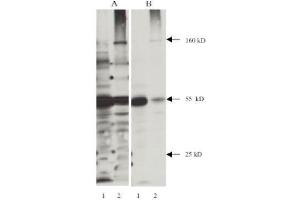 Western Blotting (WB) image for anti-Nitrotyrosine antibody (ABIN264465) (Nitrotyrosine 抗体)