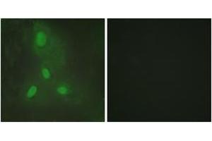 Immunofluorescence (IF) image for anti-BTB and CNC Homology 1, Basic Leucine Zipper Transcription Factor 1 (BACH1) (AA 131-180) antibody (ABIN2889311) (BACH1 抗体  (AA 131-180))