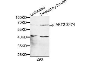 Western blot analysis of extracts of 293 cell line, using phospho-AKT2-S474 antibody. (AKT2 抗体  (pSer474))