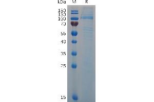 Mouse VWF (23-763) Protein, His Tag on SDS-PAGE under reducing condition. (VWF Protein (AA 23-763) (His tag))