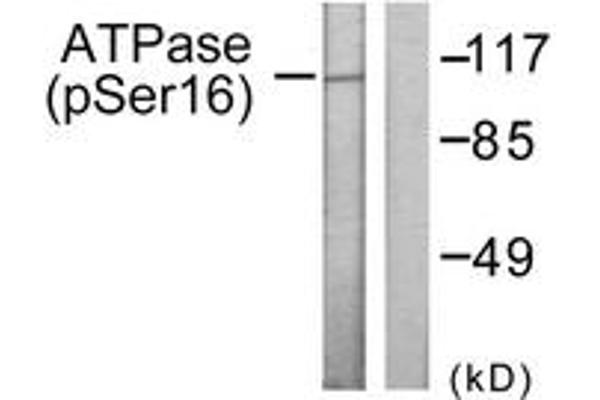 ATPase 抗体  (pSer16)