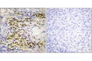 Immunohistochemistry analysis of paraffin-embedded human ovary, using Akt (Phospho-Thr72) Antibody. (AKT1 抗体  (pThr72))