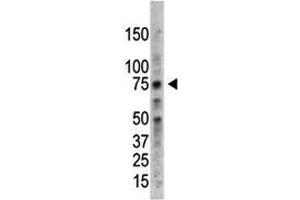 PRMT5 antibody used in western blot to detect PRMT5 in HL-60 cell lysate (PRMT5 抗体  (AA 591-621))