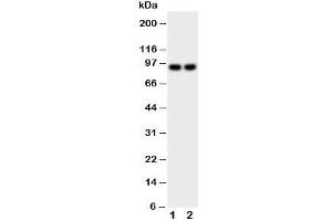 Western blot testing with Malt1 antibody; Lane 1: MCF-7;  2: HeLa cell lysate. (MALT1 抗体  (C-Term))